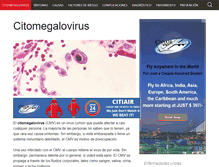 Tablet Screenshot of citomegalovirus.net